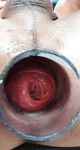 anal soi 2