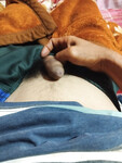 Bướm múp